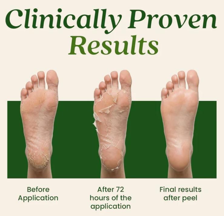 Foot Peel Mask