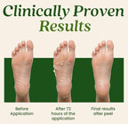 Foot Peel Mask